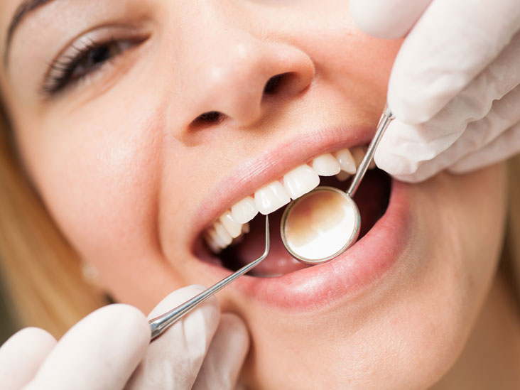 All You Need To Know About Teeth Cleaning