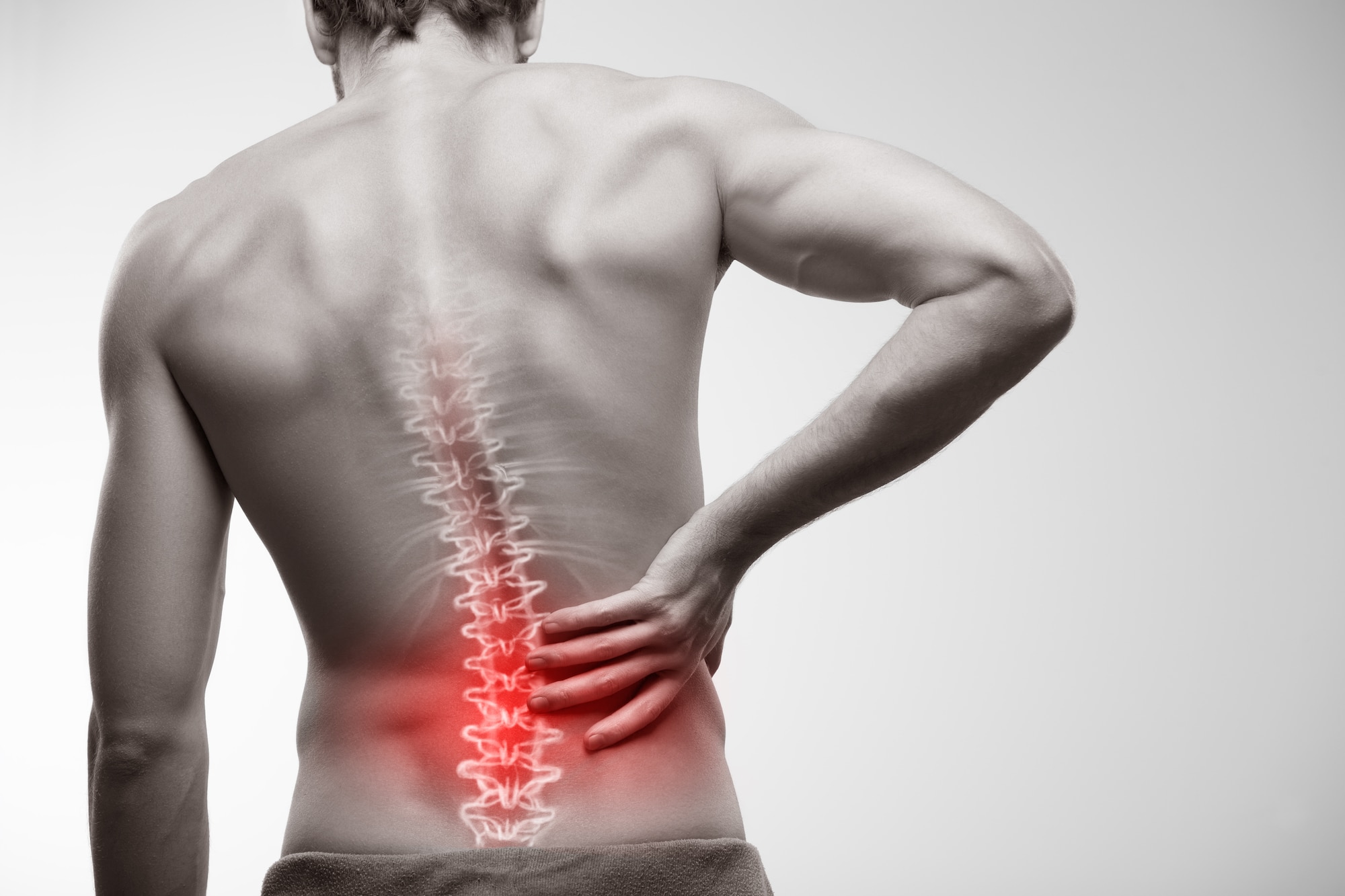 What Makes You A Good Candidate for Spinal Fusion?