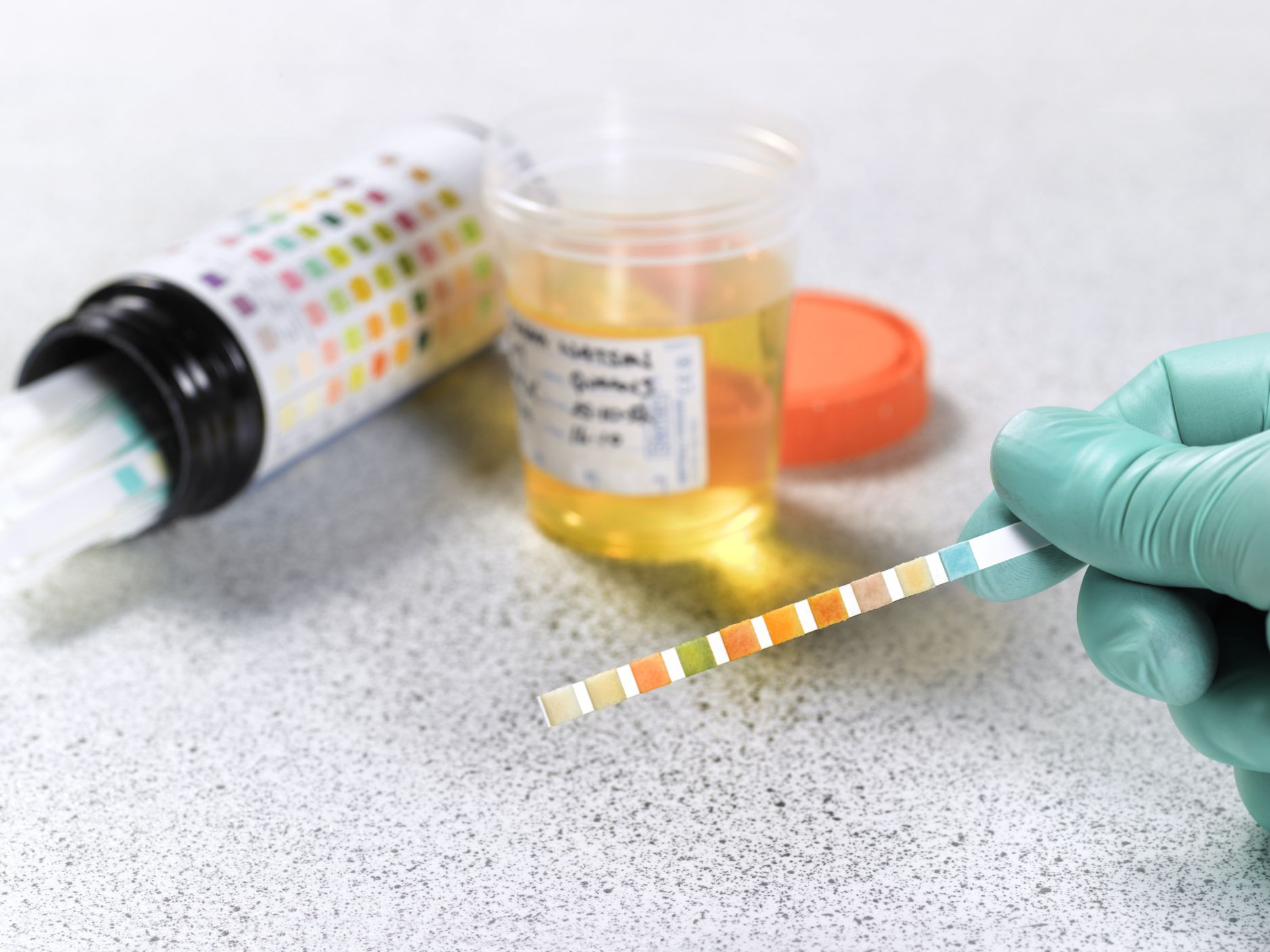 All You Need To Know About Drug Tests - Ultra Medica