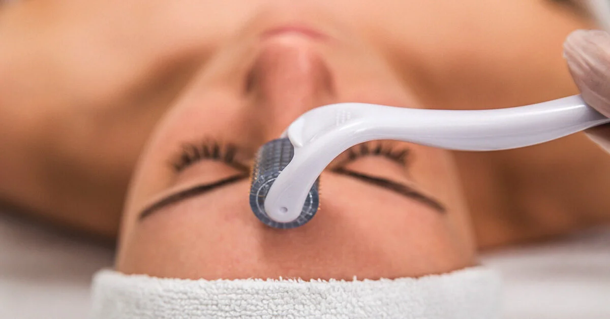Most Commonly Asked Questions about Microneedling