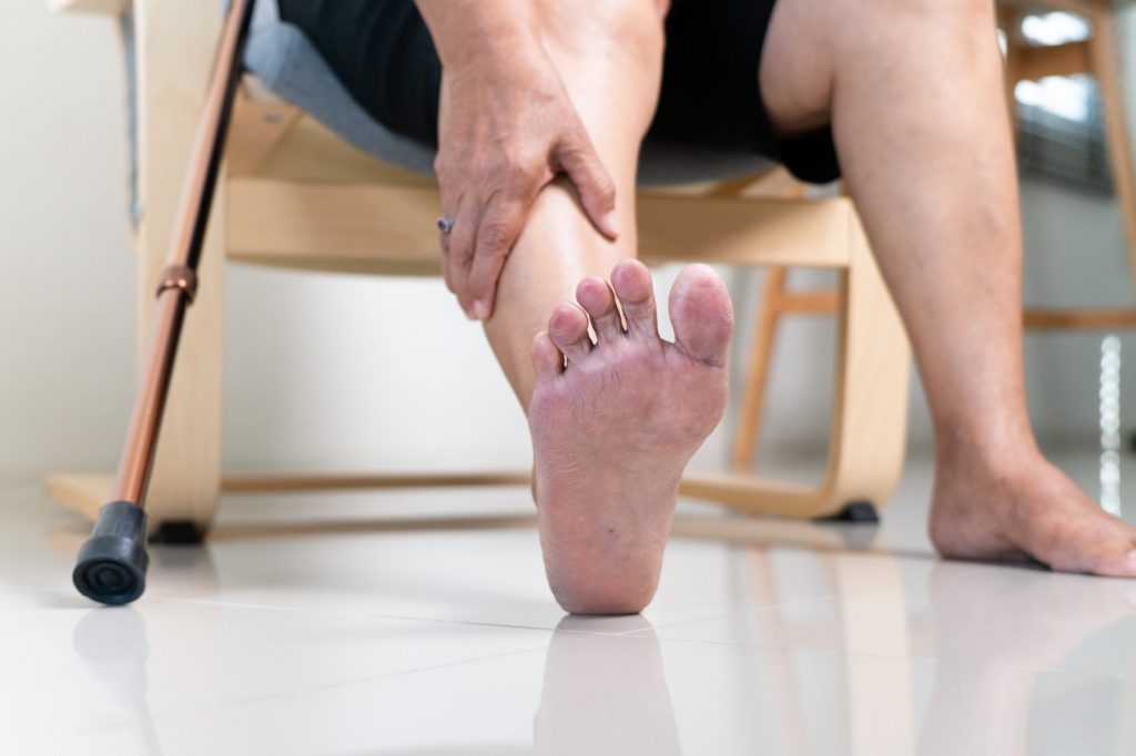 Common Myths Associated with Peripheral Artery Disease