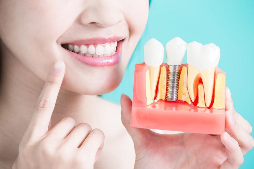 How Smoking Affects Dental Implants in Manhasset