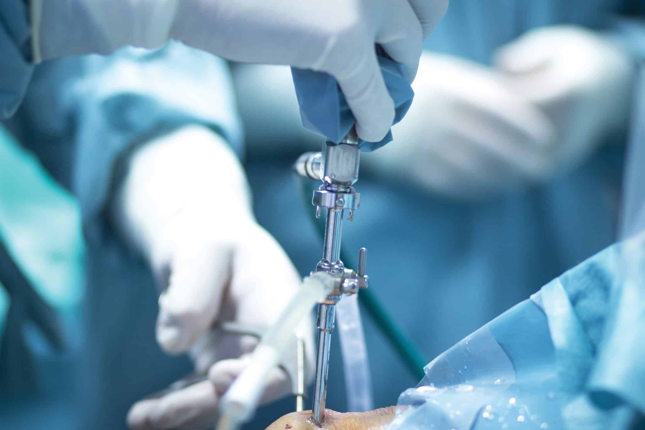 The Advancements in Orthopedic Surgery