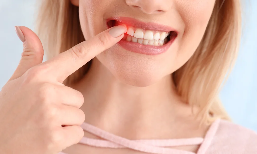 Top Dental Problems and How to Avoid Them