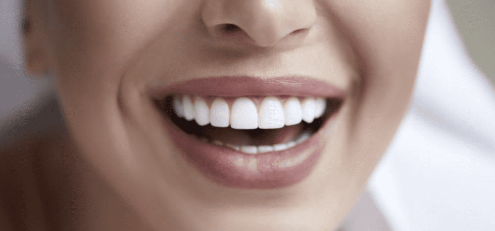 Feel More Confident with a Brighter Smile