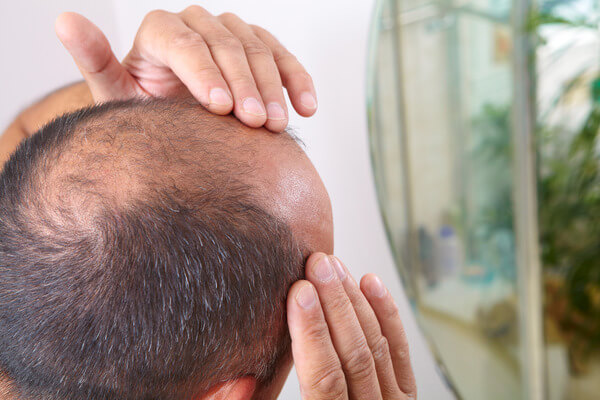 Hair Restoration Procedure