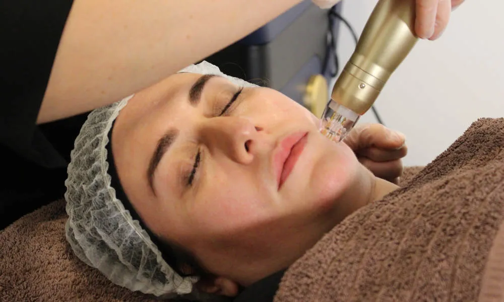 Sylfirm X: Transform Your Skin with Revolutionary Technology