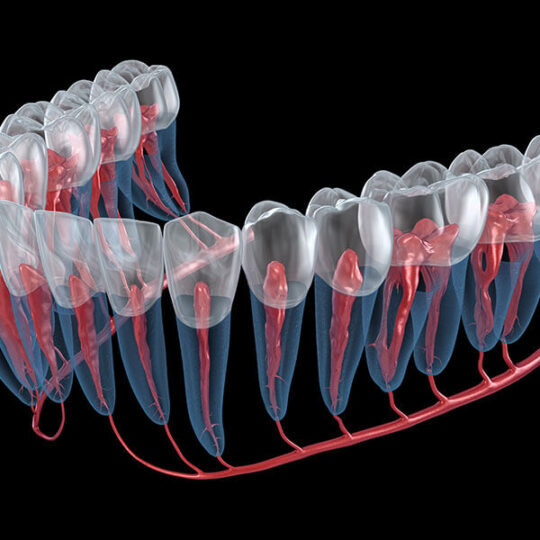 Root canal retreatment