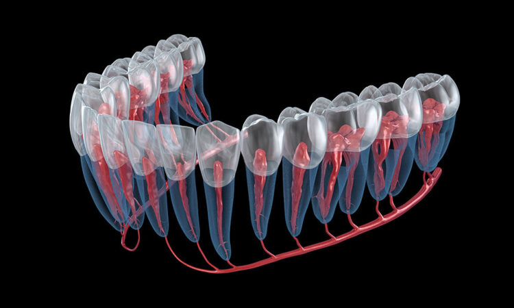 Root canal retreatment