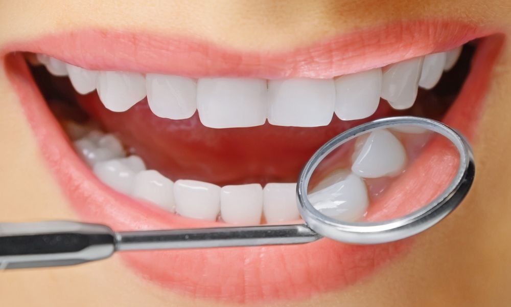 Teeth Implants vs. Other Dental Solutions: A Cost Comparison