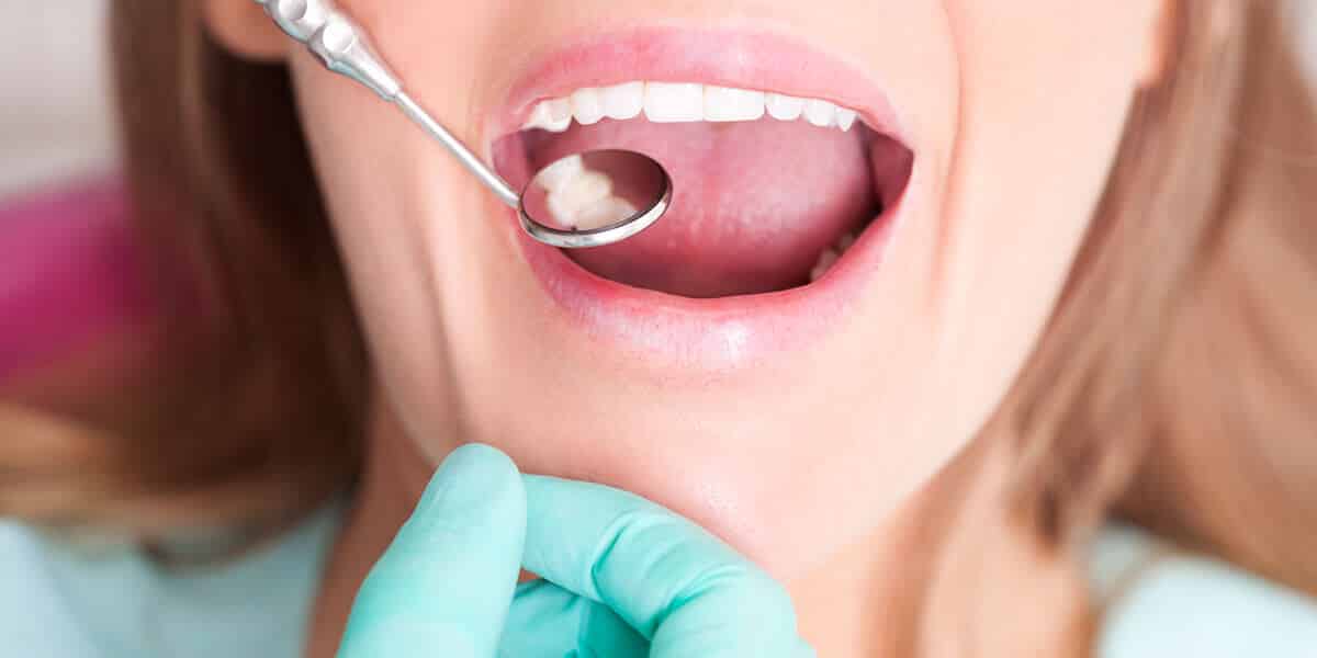 Oral Cancer Screening in Hillsdale: What a Dentist Looks For?